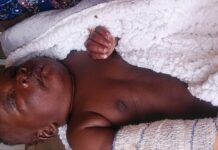 Parents Struggle to Raise Funds to Treat their 3-Month-Old Son Attacked by a Chimpanzee